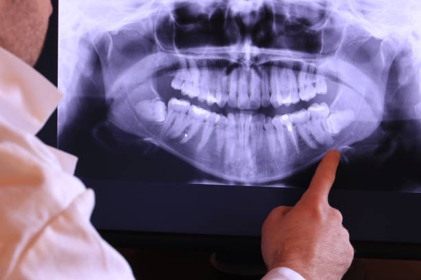 Best After-Hours Emergency Dentist in Homestead Meadows South, TX